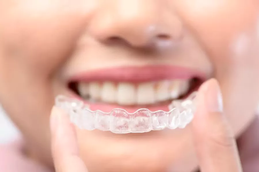 انواع وسایل ارتودنسی