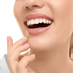 باندینگ دندان