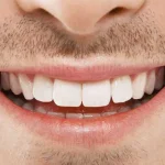 چه کسانی نمی توانند کامپوزیت کنند؟