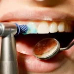 پالیش کامپوزیت چیست؟