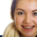 سن مناسب ارتودنسی