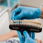 بهترین رنگ روکش دندان